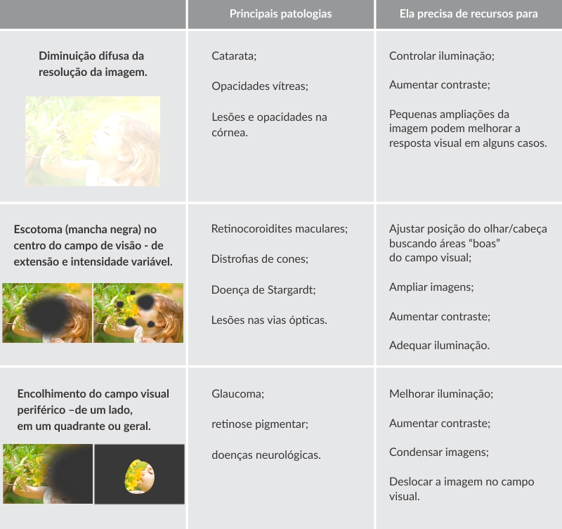 Baixa visão - alterações visuais