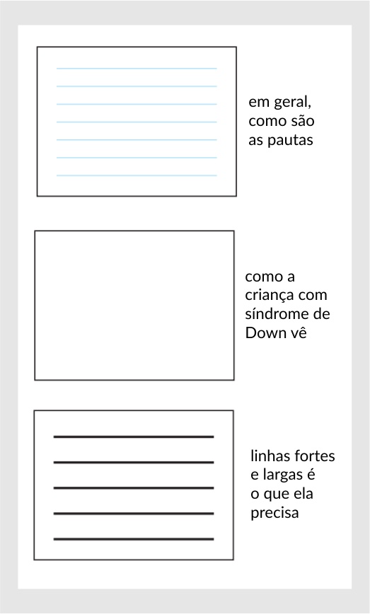 redução de acuidade na criança com síndrome de Down